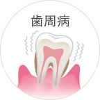 歯周病